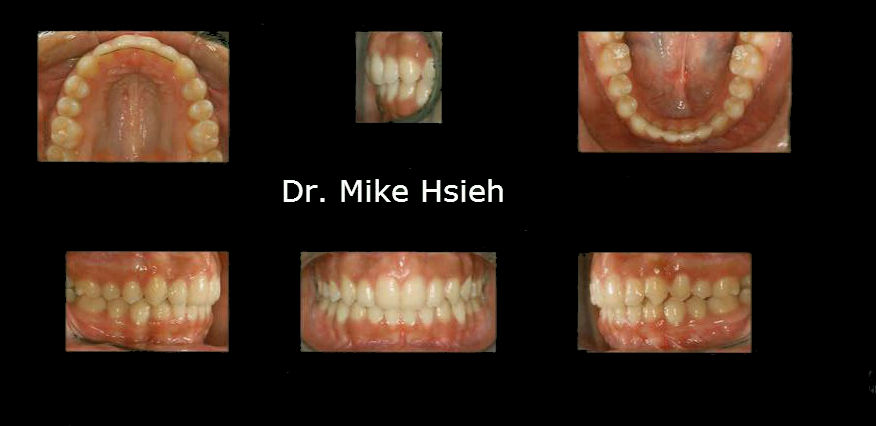 mill creek wa dentist