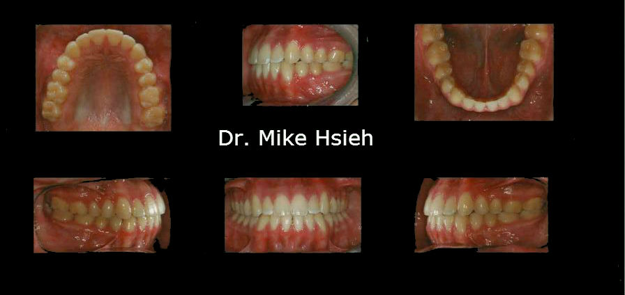 dentists in mill creek wa