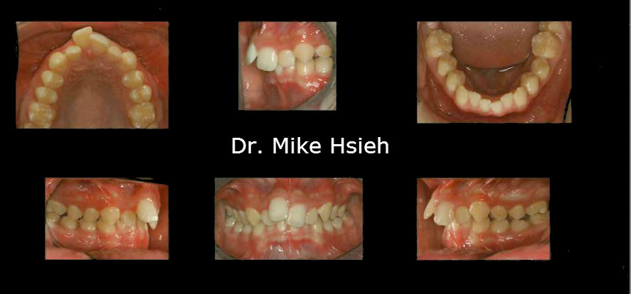 dental wa mill creek