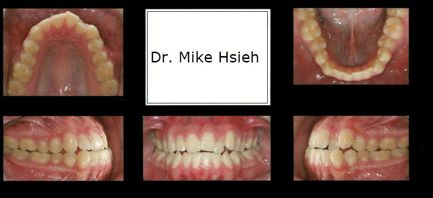 dentists in mill creek wa