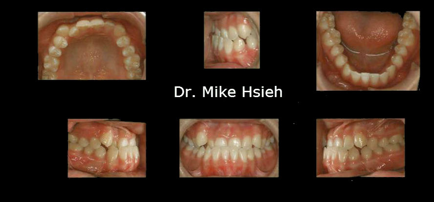 dentist open late in mill creek wa