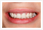 dental crowns after mill creek dental office